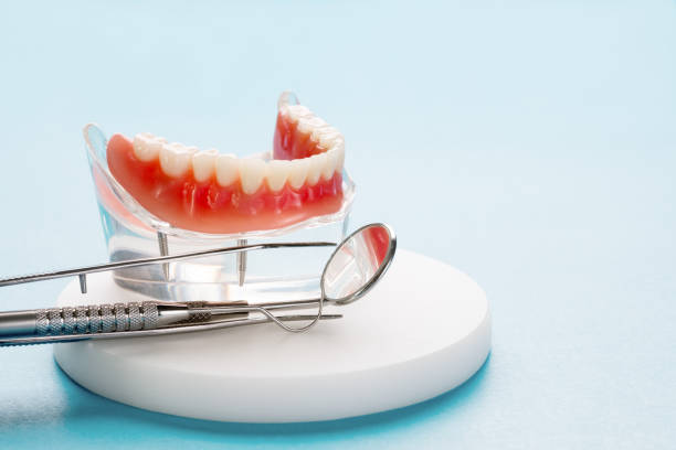 Best Veneers and Lumineers  in Piednt, MO
