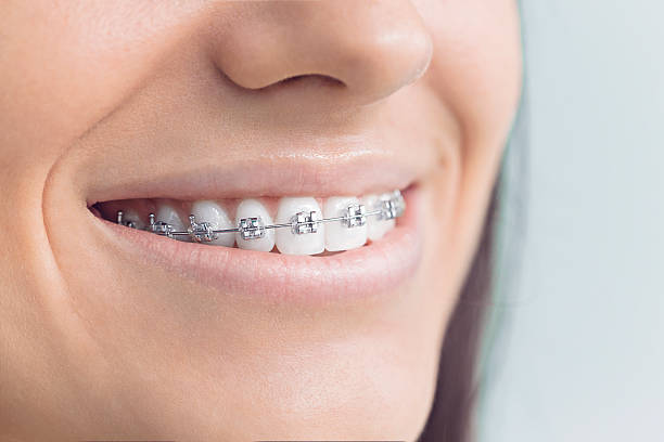 Best Invisalign and Clear Aligners  in Piednt, MO